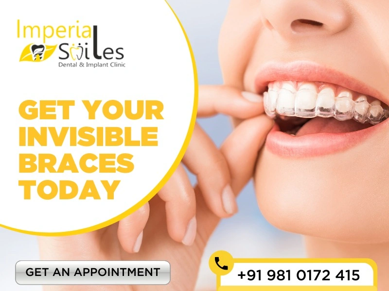 Dental Implant Clinic in Gurgaon