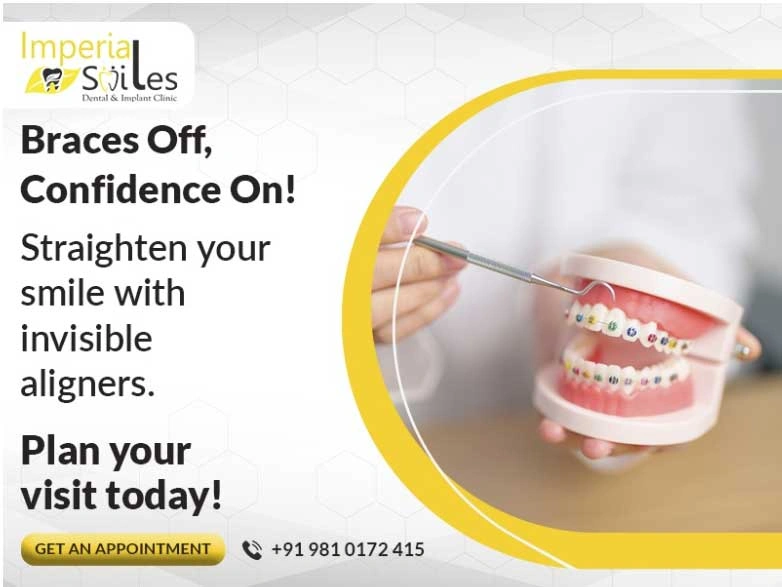 Dental Implant Clinic in Gurgaon