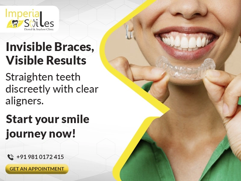 Dental Implant Clinic in Gurgaon