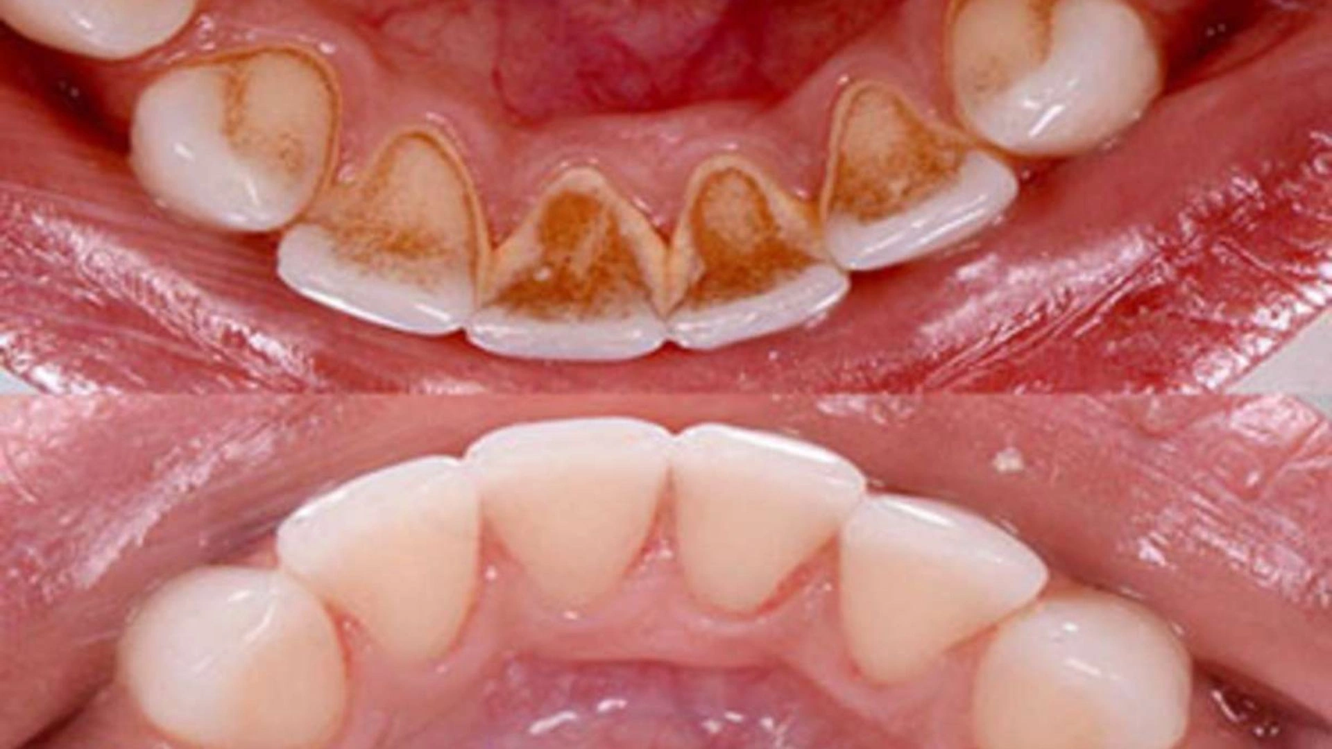 Dental Implant Clinic in Gurgaon