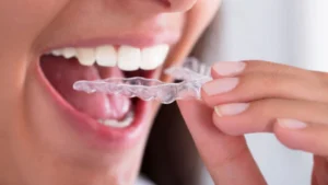 Mouth guard for teeth grinding
